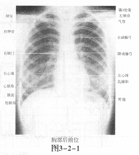 题目图片