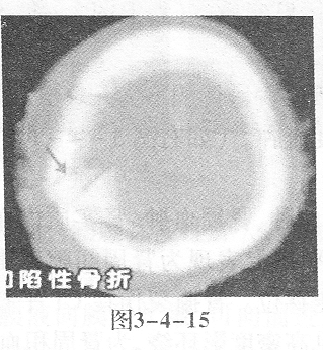 题目图片