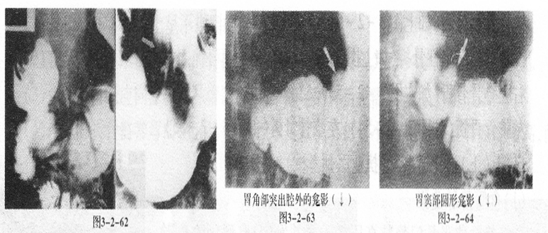 题目图片