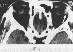 题目图片