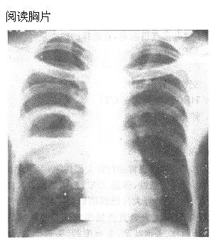 题目图片