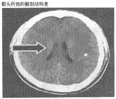 题目图片