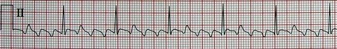 题目图片