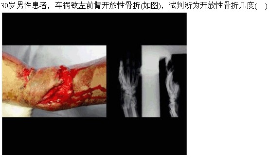 题目图片