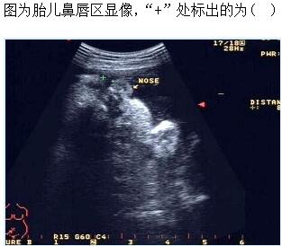 题目图片