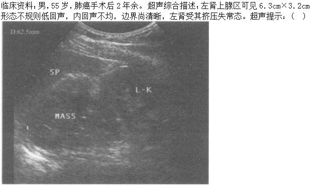 题目图片